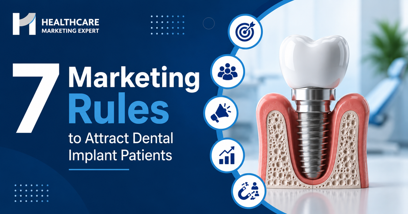 7 Marketing Rules to Attract Dental Implant Patients
